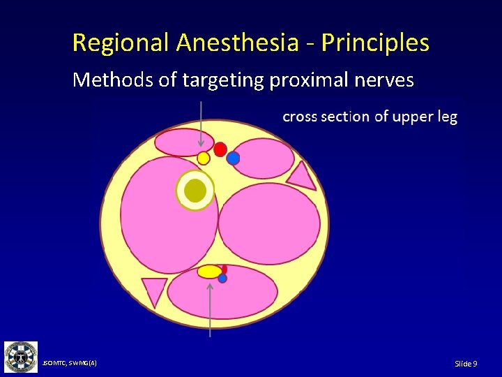 Regional Anesthesia - Principles Methods of targeting proximal nerves JSOMTC, SWMG(A) Slide 9 