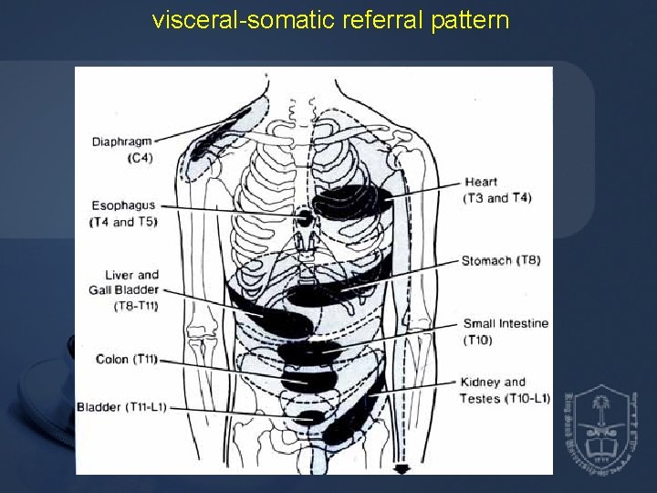 visceral-somatic referral pattern 