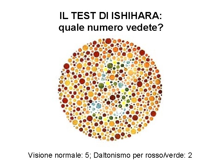 IL TEST DI ISHIHARA: quale numero vedete? Visione normale: 5; Daltonismo per rosso/verde: 2