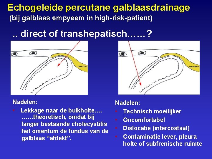 Echogeleide percutane galblaasdrainage (bij galblaas empyeem in high-risk-patient) . . direct of transhepatisch……? Nadelen: