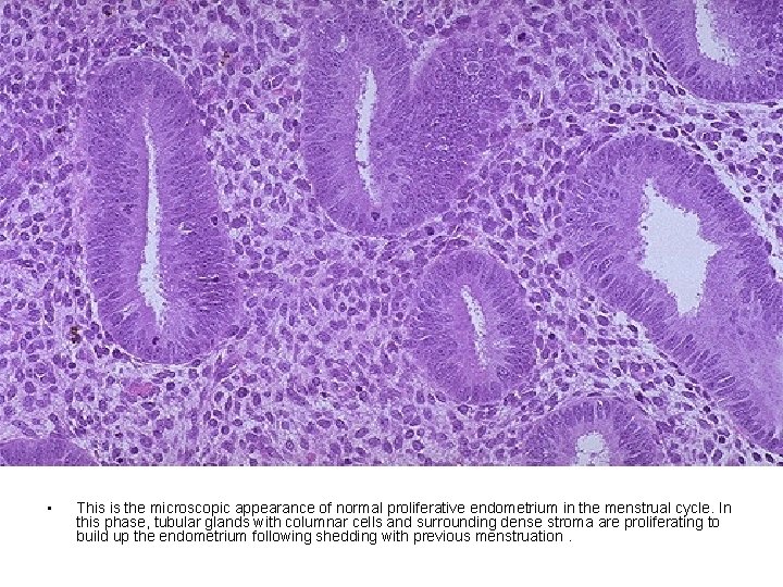 • This is the microscopic appearance of normal proliferative endometrium in the menstrual • This is the microscopic appearance of normal proliferative endometrium in the menstrual