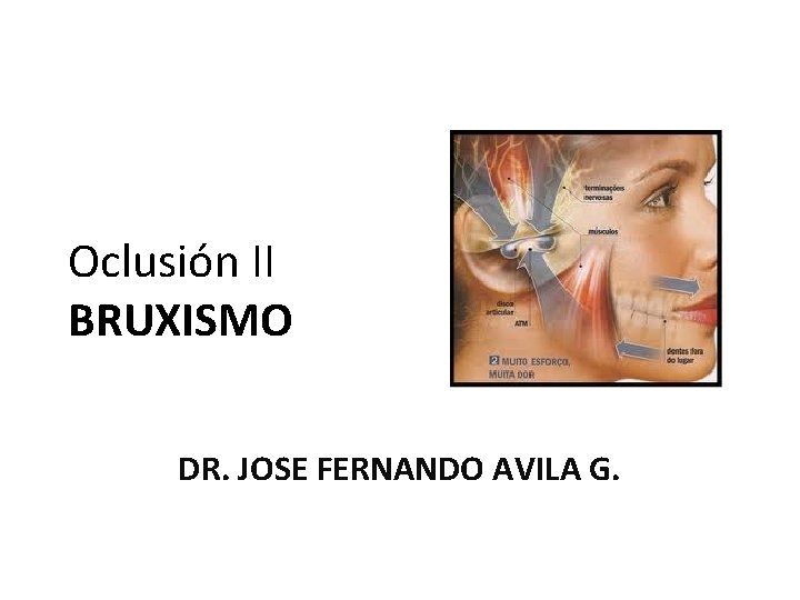 Oclusión II BRUXISMO DR. JOSE FERNANDO AVILA G. 