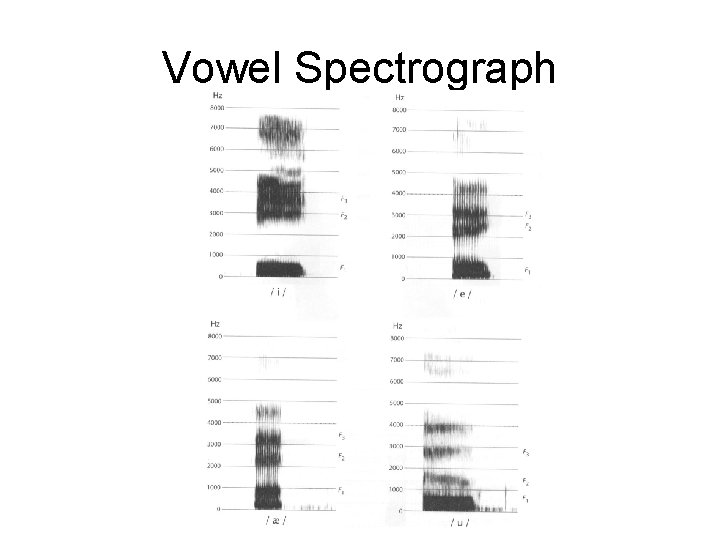 Vowel Spectrograph 