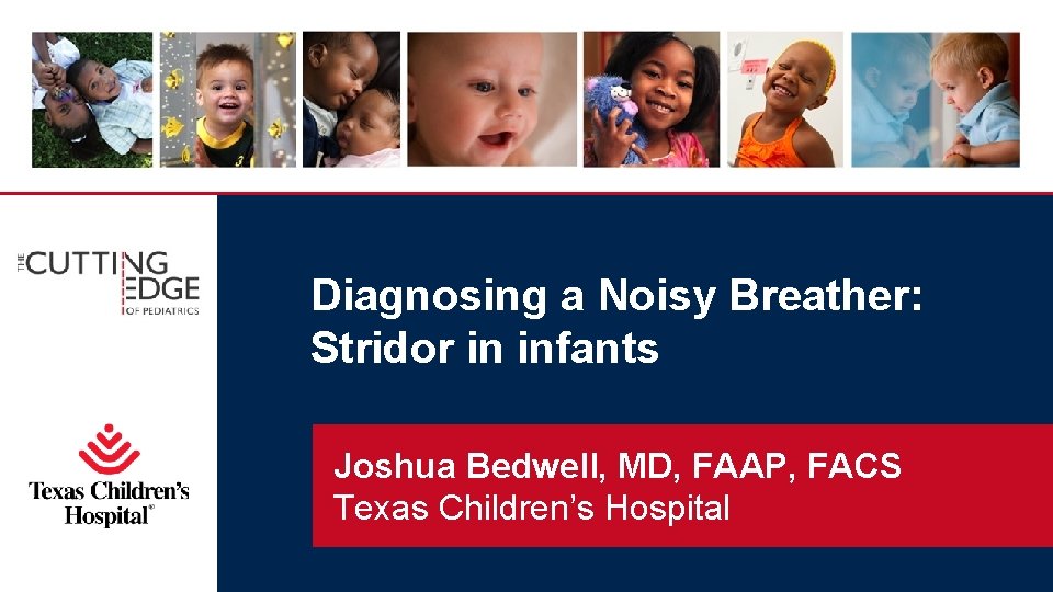 Diagnosing a Noisy Breather: Stridor in infants Joshua Bedwell, MD, FAAP, FACS Texas Children’s