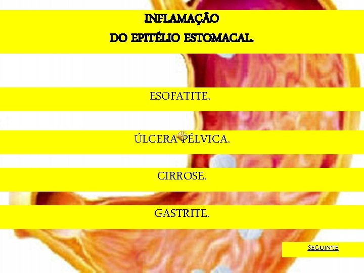 INFLAMAÇÃO DO EPITÉLIO ESTOMACAL. ESOFATITE. ÚLCERA PÉLVICA. CIRROSE. GASTRITE. SEGUINTE 