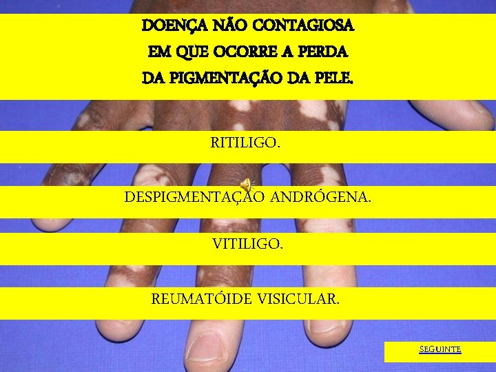 DOENÇA NÃO CONTAGIOSA EM QUE OCORRE A PERDA DA PIGMENTAÇÃO DA PELE. RITILIGO. DESPIGMENTAÇÃO