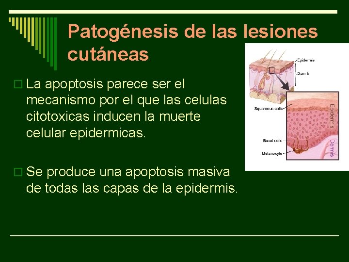 Patogénesis de las lesiones cutáneas o La apoptosis parece ser el mecanismo por el Patogénesis de las lesiones cutáneas o La apoptosis parece ser el mecanismo por el