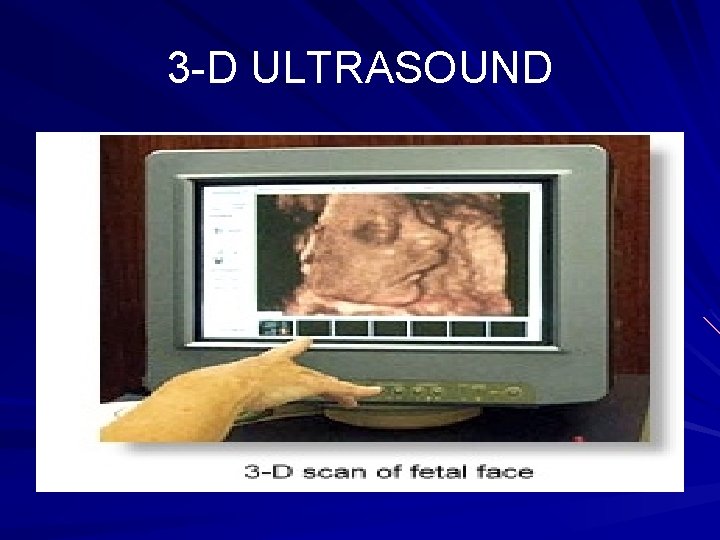 3 -D ULTRASOUND 