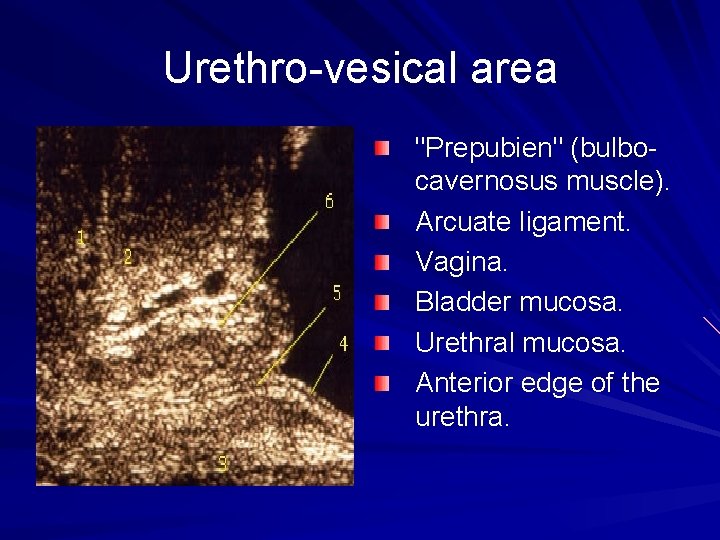 Urethro-vesical area "Prepubien" (bulbocavernosus muscle). Arcuate ligament. Vagina. Bladder mucosa. Urethral mucosa. Anterior edge