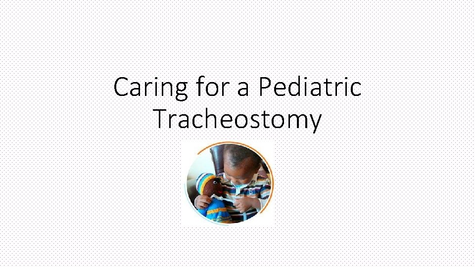 Caring for a Pediatric Tracheostomy 