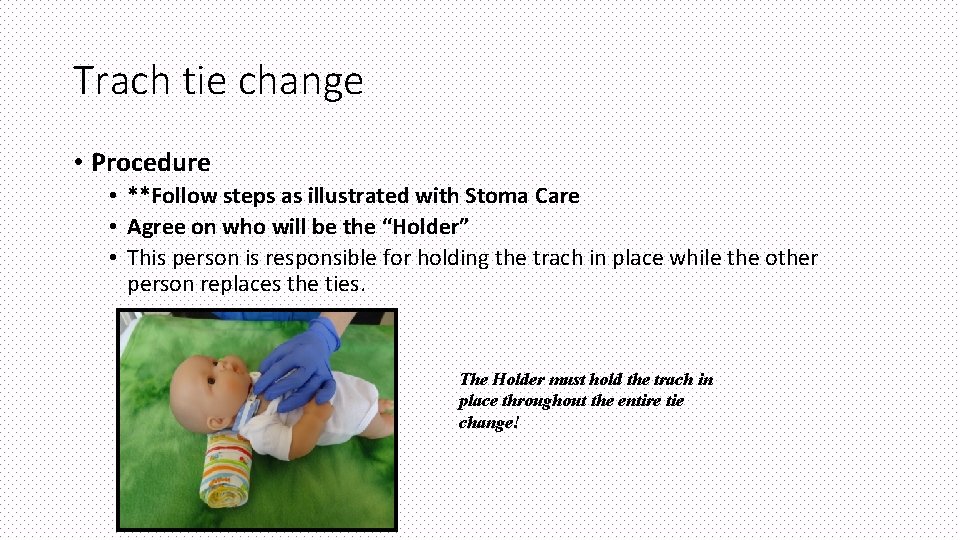 Trach tie change • Procedure • **Follow steps as illustrated with Stoma Care •