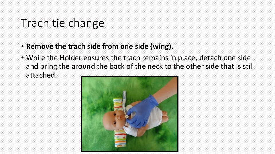 Trach tie change • Remove the trach side from one side (wing). • While