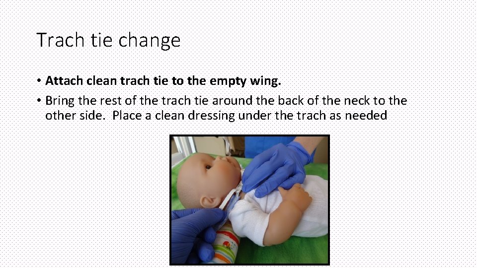 Trach tie change • Attach clean trach tie to the empty wing. • Bring