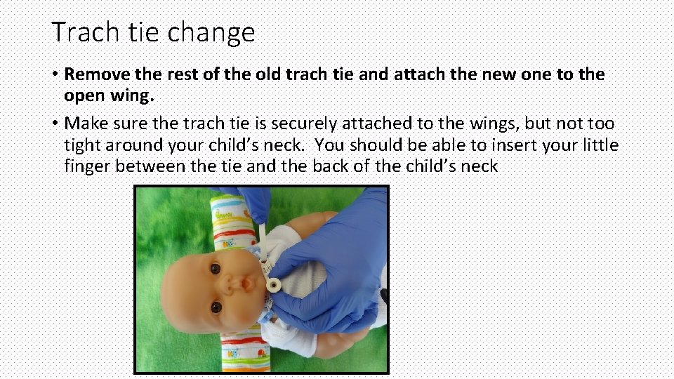 Trach tie change • Remove the rest of the old trach tie and attach