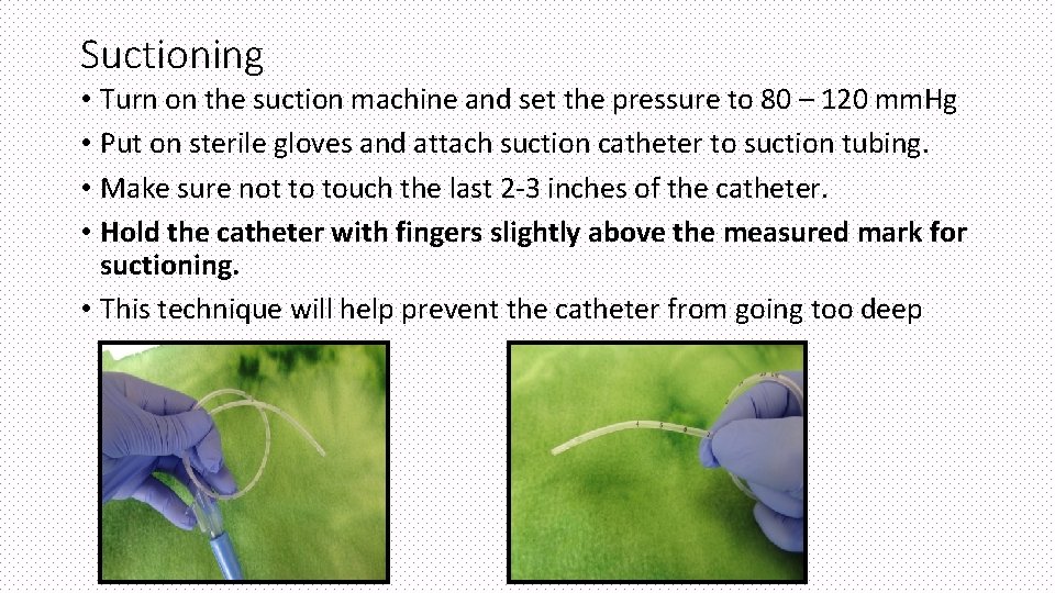 Suctioning • Turn on the suction machine and set the pressure to 80 –