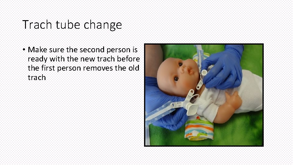 Trach tube change • Make sure the second person is ready with the new