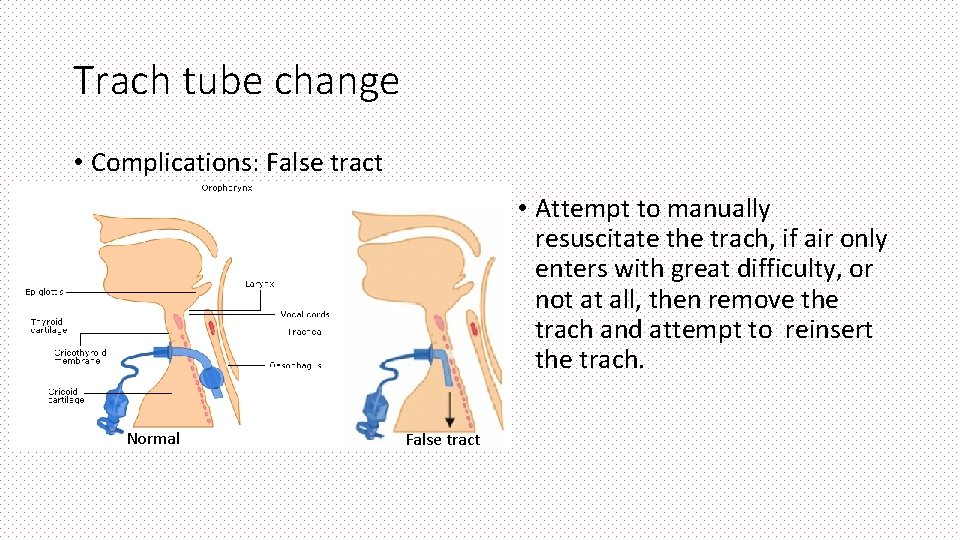 Trach tube change • Complications: False tract • Attempt to manually resuscitate the trach,
