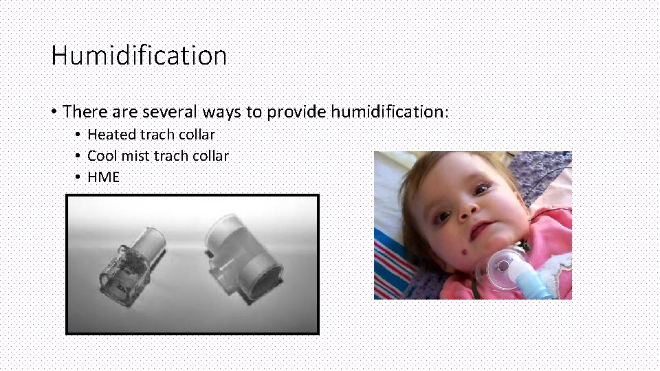 Humidification • There are several ways to provide humidification: • Heated trach collar •