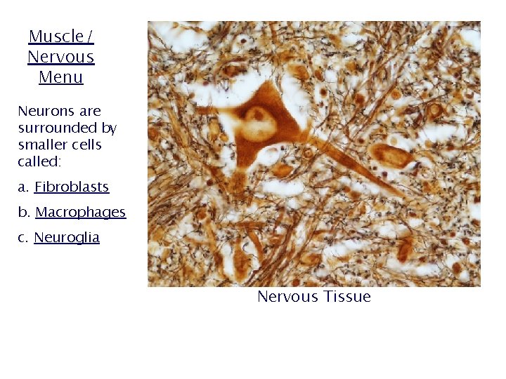 Muscle/ Nervous Menu Neurons are surrounded by smaller cells called: a. Fibroblasts b. Macrophages