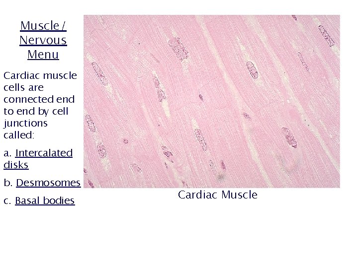 Muscle/ Nervous Menu Cardiac muscle cells are connected end to end by cell junctions