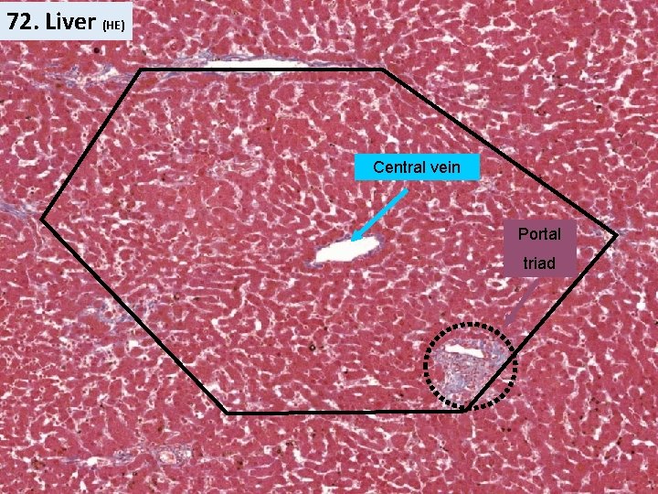 72. Liver (HE) Central vein Portal triad 