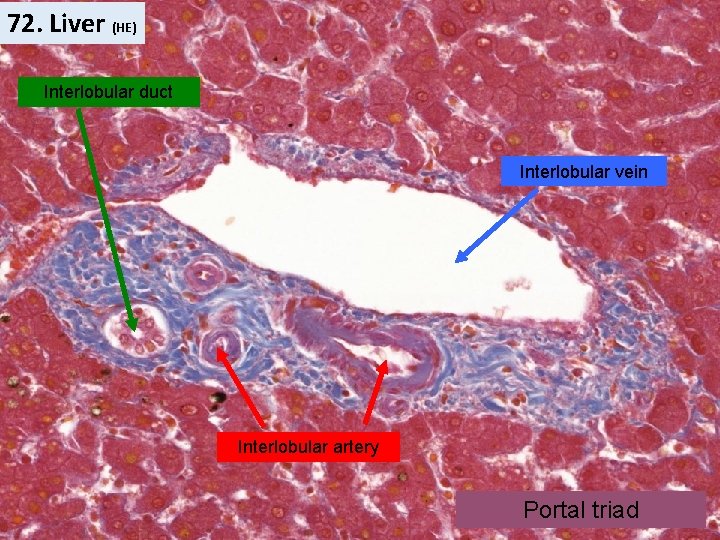 72. Liver (HE) Interlobular duct Interlobular vein Interlobular artery Portal triad 