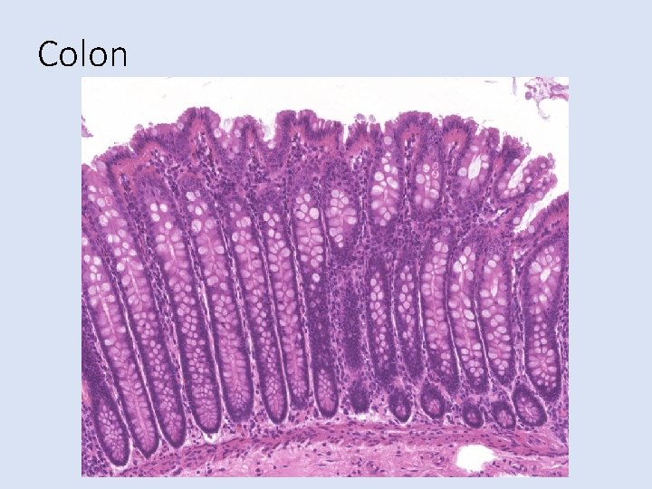 Colon 