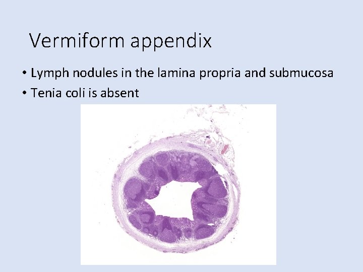 Vermiform appendix • Lymph nodules in the lamina propria and submucosa • Tenia coli