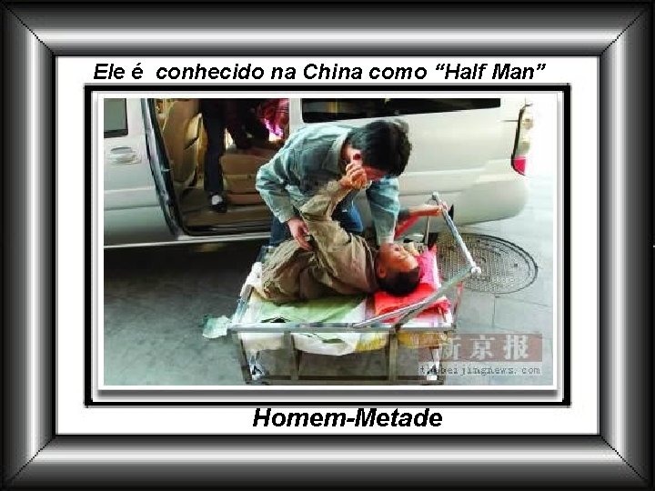 Ele é conhecido na China como “Half Man” Homem-Metade Ele é conhecido na China como “Half Man” Homem-Metade