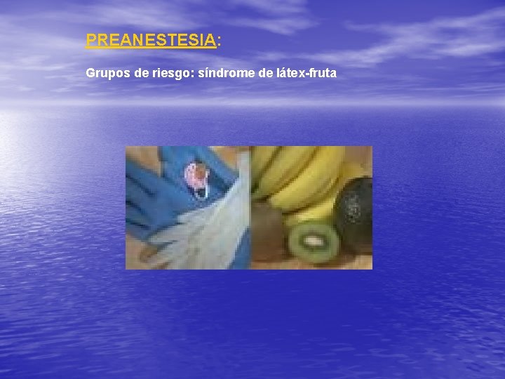 PREANESTESIA: Grupos de riesgo: síndrome de látex-fruta 