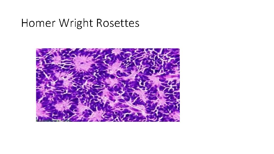 Homer Wright Rosettes Homer Wright Rosettes