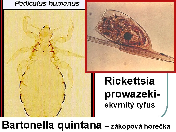 Rickettsia prowazekiskvrnitý tyfus Bartonella quintana – zákopová horečka 