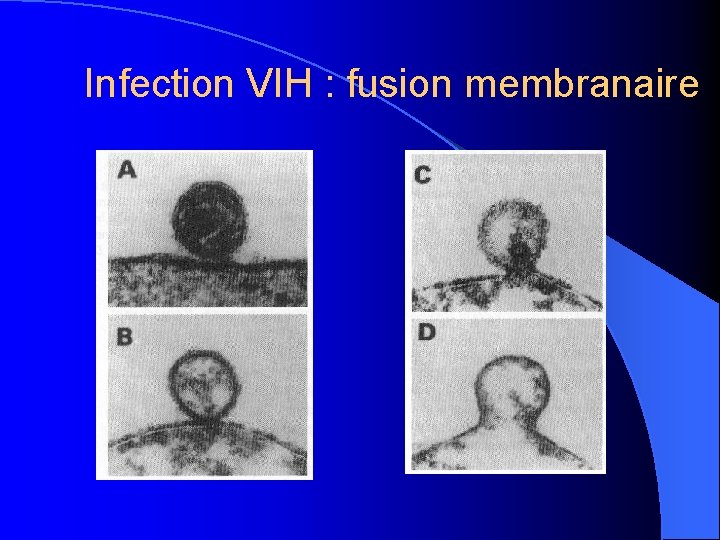 Infection VIH : fusion membranaire 