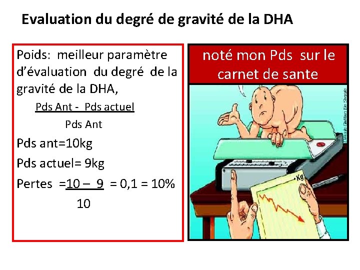 Evaluation du degré de gravité de la DHA Poids: meilleur paramètre d’évaluation du degré