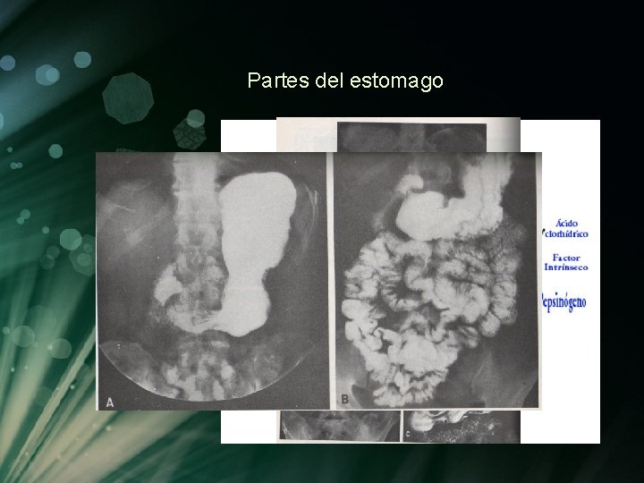 Partes del estomago Partes del estomago
