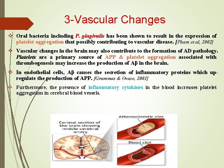 3 -Vascular Changes v Oral bacteria including P. gingivalis has been shown to result