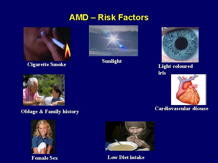 AMD Treatment Options 1 Eyeball Made up of