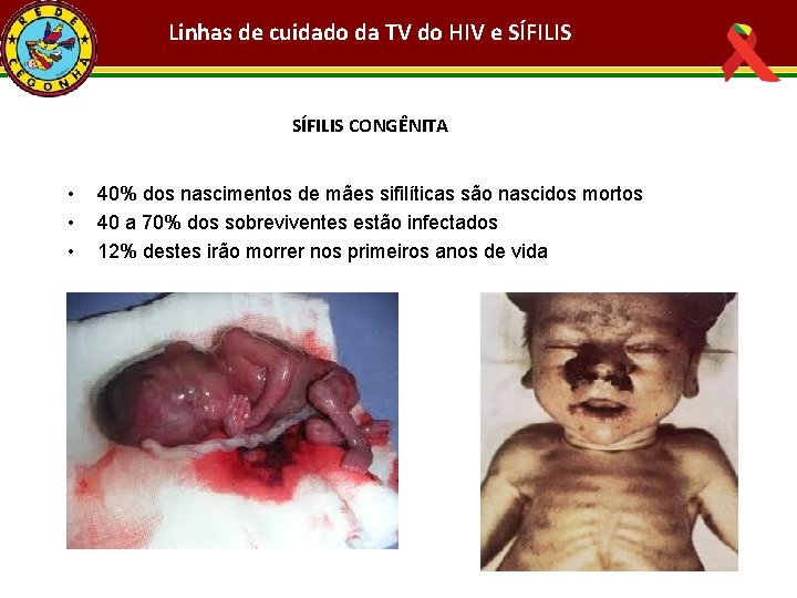 Linhas de cuidado da TV do HIV e SÍFILIS CONGÊNITA • • • 40%