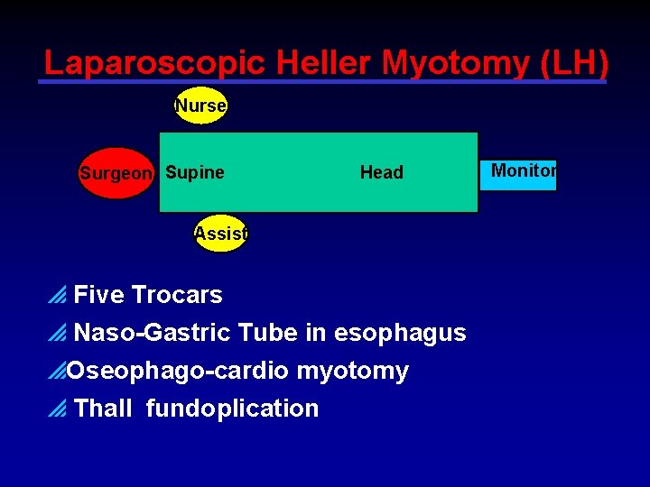 Laparoscopic Heller Myotomy (LH) Nurse Surgeon Supine Head Assist p Five Trocars p Naso-Gastric