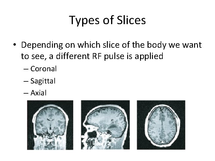 Types of Slices • Depending on which slice of the body we want to