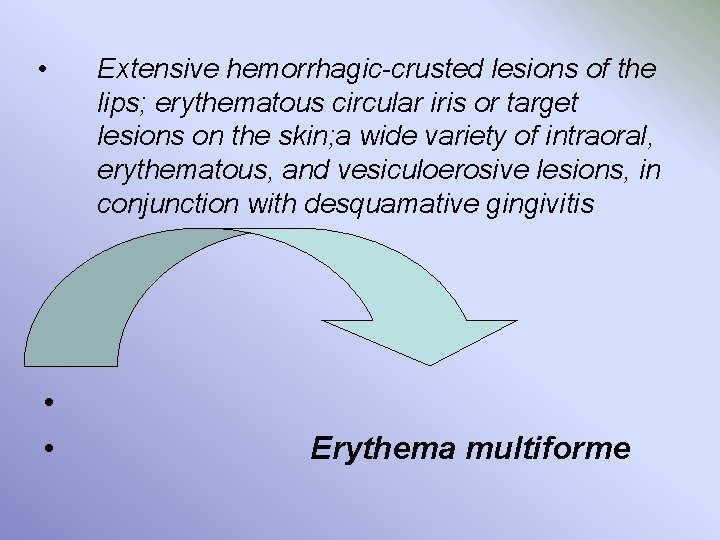 • • • Extensive hemorrhagic-crusted lesions of the lips; erythematous circular iris or