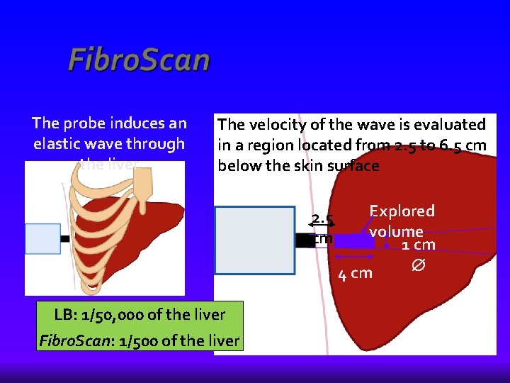 The probe induces an elastic wave through the liver The velocity of the wave