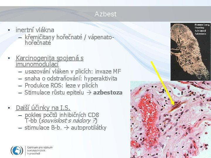 Azbest • inertní vlákna – křemičitany hořečnaté / vápenatohořečnaté • Karcinogenita spojená s imunomodulací