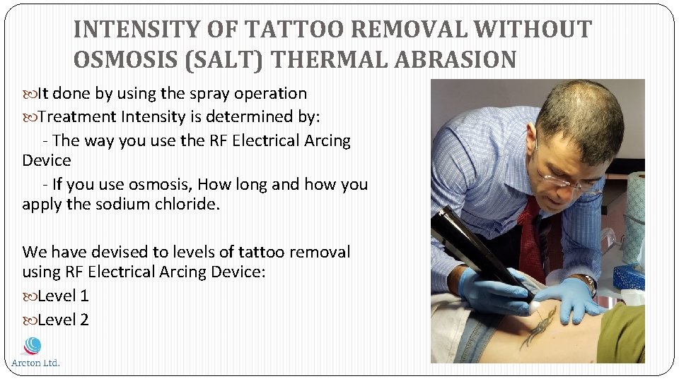 INTENSITY OF TATTOO REMOVAL WITHOUT OSMOSIS (SALT) THERMAL ABRASION It done by using the