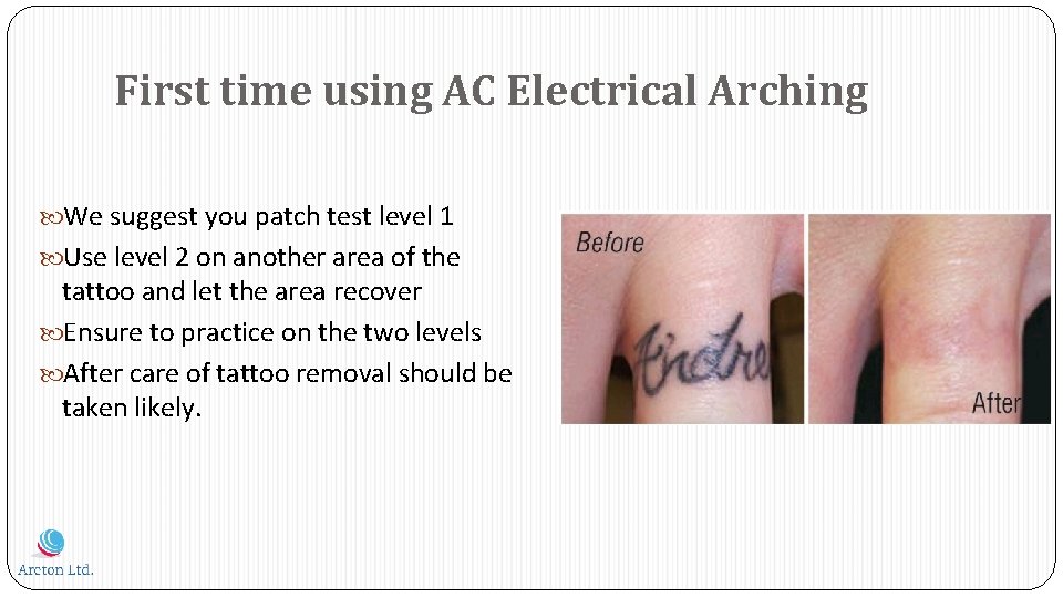 First time using AC Electrical Arching We suggest you patch test level 1 Use