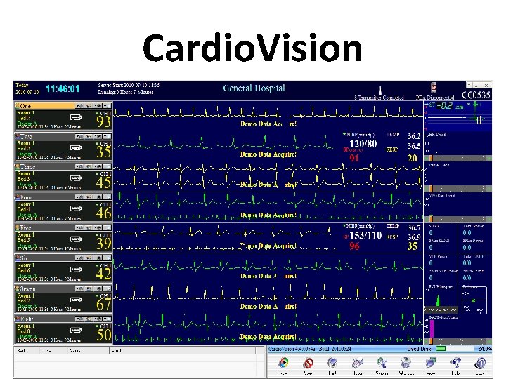 Cardio. Vision 