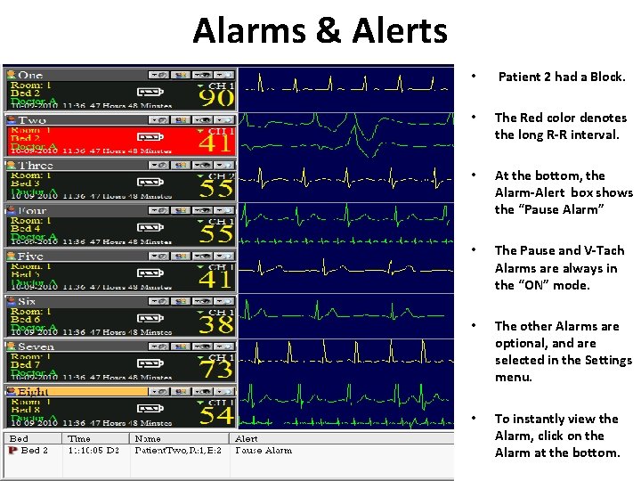 Alarms & Alerts • Patient 2 had a Block. • The Red color denotes