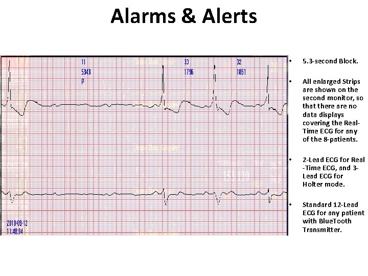 Alarms & Alerts • 5. 3 -second Block. • All enlarged Strips are shown