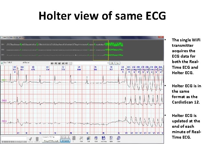 Holter view of same ECG • The single Wi. Fi transmitter acquires the ECG