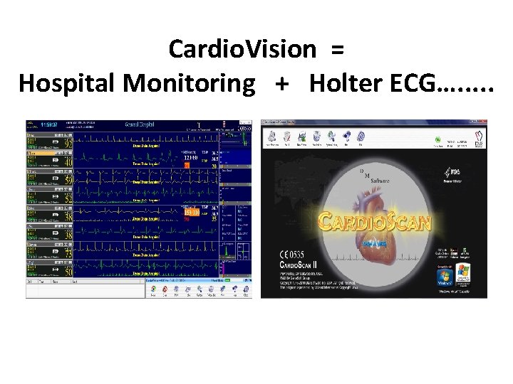 Cardio. Vision = Hospital Monitoring + Holter ECG…. . . 